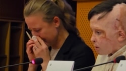 Переводчица Европарламента плачет от рассказа 11-летнего украинского мальчика с тяжелейшими ожогами 